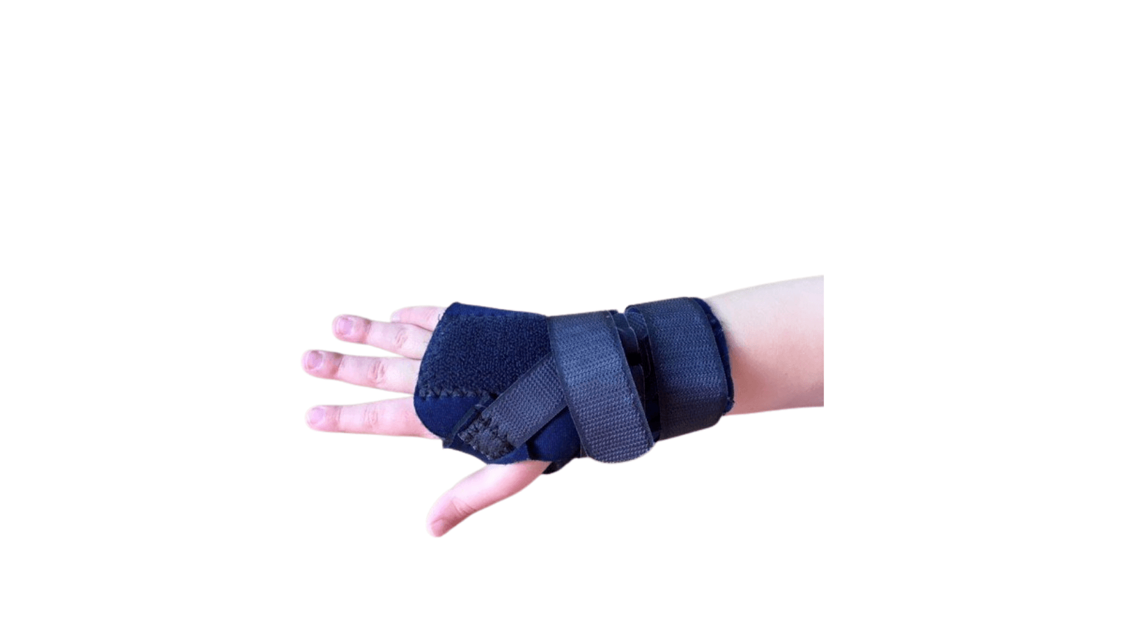 Splinting - ABC Pediatric Therapy